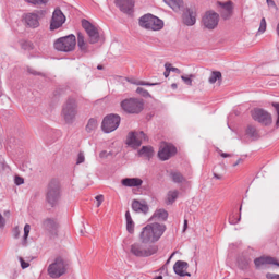 Histopathology slide-report sample